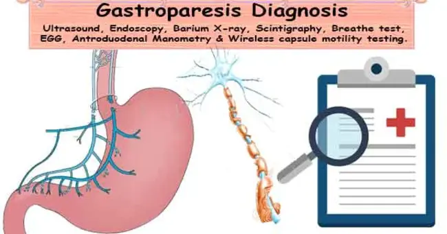 Gastroparesis Cardinal Symptom Index : 胃轻瘫主要症状指数