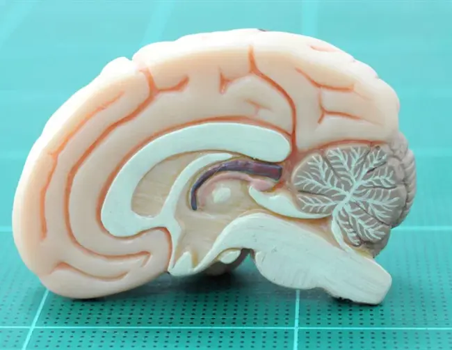 temporoparietaloccipital disconnection : 颞侧锁骨断开