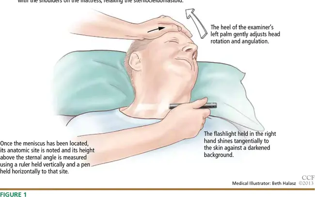 Jugular Venous Pressure : 颈静脉压