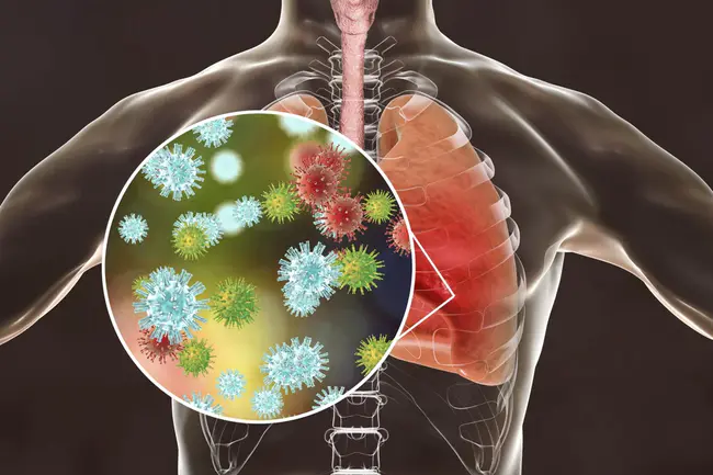 Pneumococcal Polysaccharide Vaccine (23-valent) see PPSV23 : 肺炎球菌多糖疫苗（23价）见PPSV23