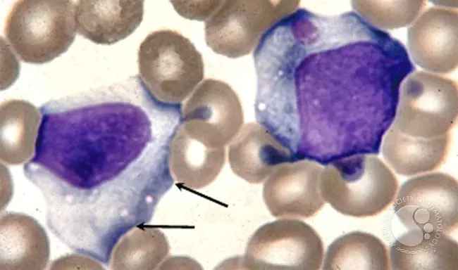 Mononuclear Leucocyte : 单核白细胞