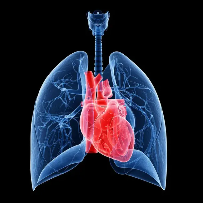 Pulmonary Artery Occluded Pressure : 肺动脉闭塞压