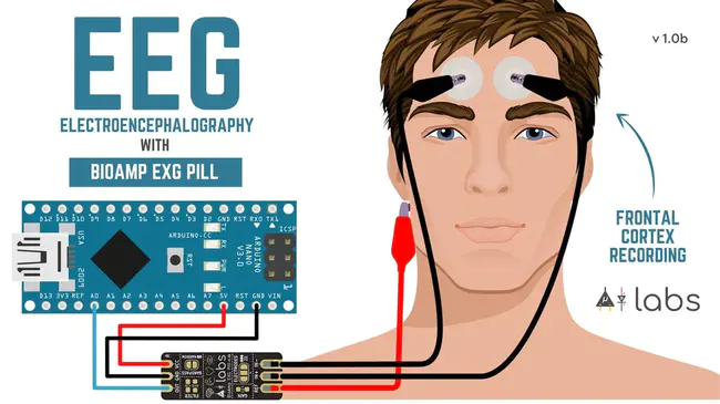 Electro Encephalo Gram : 脑电图