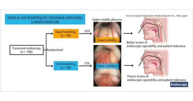 Per Oral Endoscopic Myotomy : 经口腔内窥镜切开术