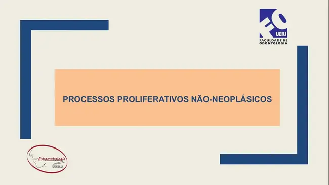 Processos Proliferativos Não Neoplásicos : N和肿瘤增殖过程