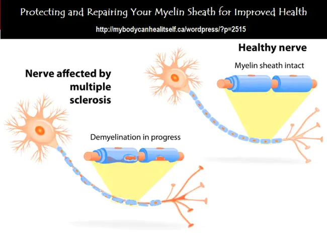 Myelin Repair Foundation : 髓磷脂修复基金会