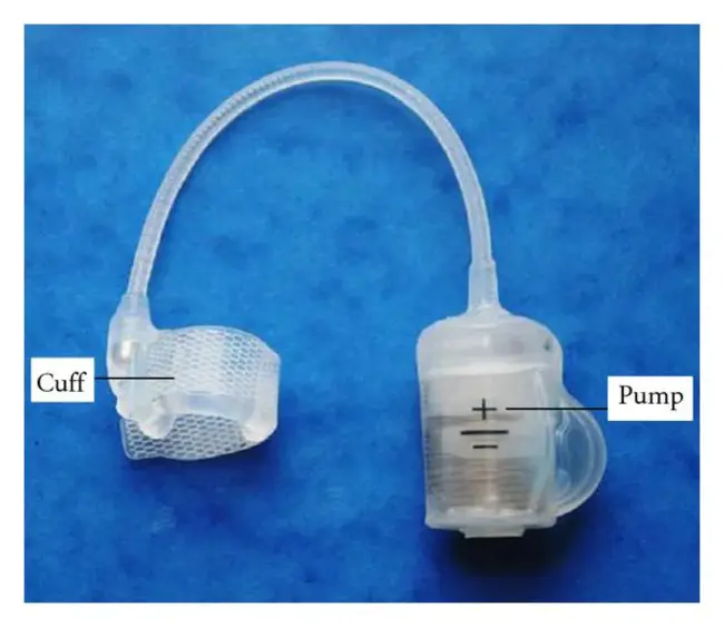 Artificial Urinary Sphincter : 人工尿道括约肌