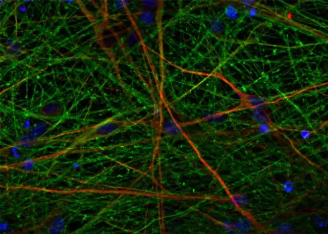 Neural Stem Cell Institute : 神经干细胞研究所