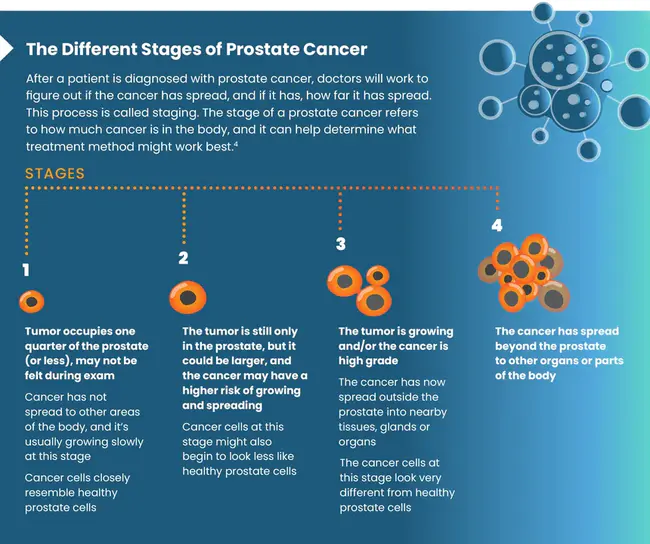 Benign Prostate Enlargement : 良性前列腺增大