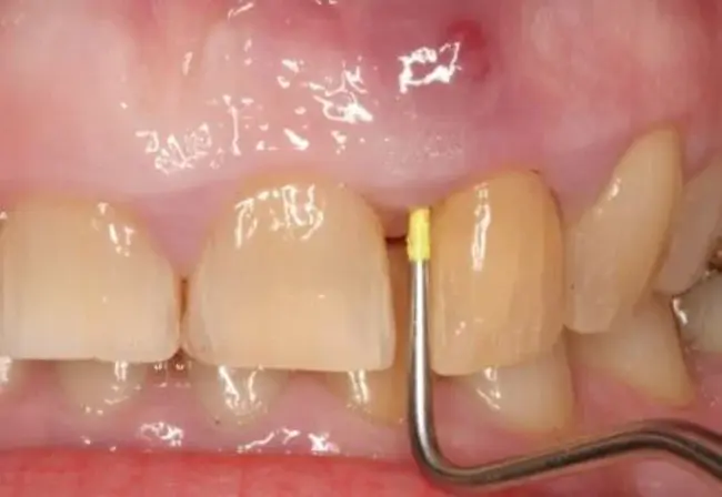 Expanded Practice Dental Hygienist : 扩大实践牙科保健师