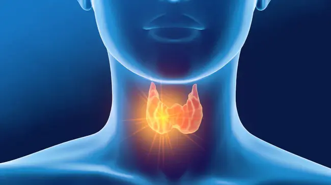 Anaplastic Carcinoma of the Thyroid : 甲状腺未分化癌