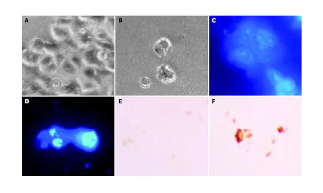 Oligomeric Proanthocyanidins : 低聚原花青素