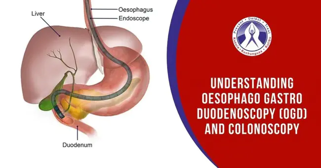 Oesophago gastro duodenoscopy : 食管胃十二指肠镜检查