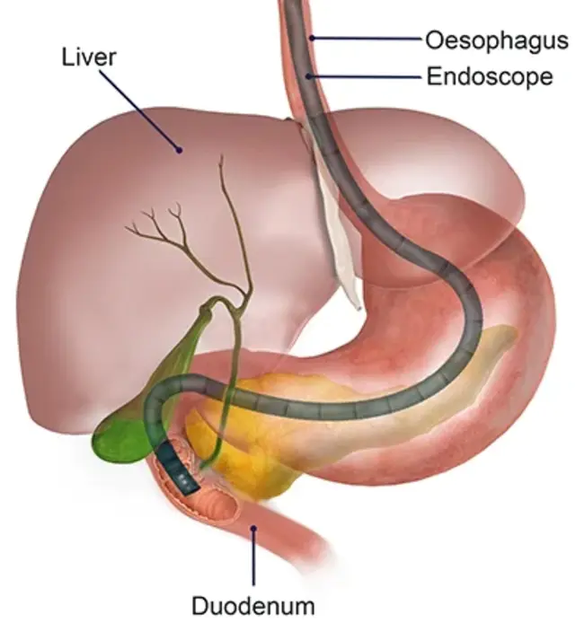 Oesophago Gastro : 食道胃