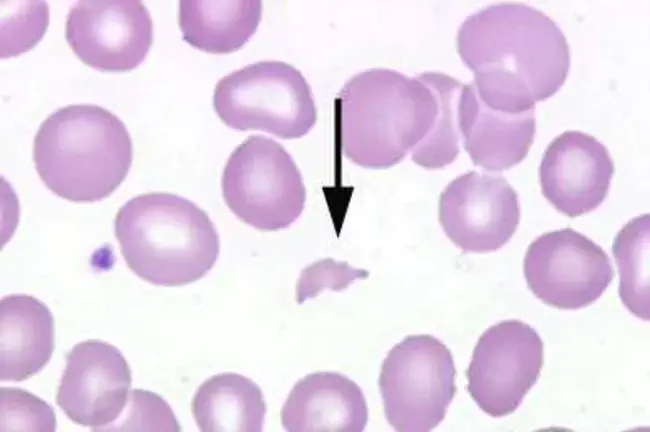 M neuron morphology : M神经元形态