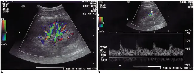 Renal Artery Diagnostic Imaging Study in Hypertension : 高血压肾动脉诊断影像学研究