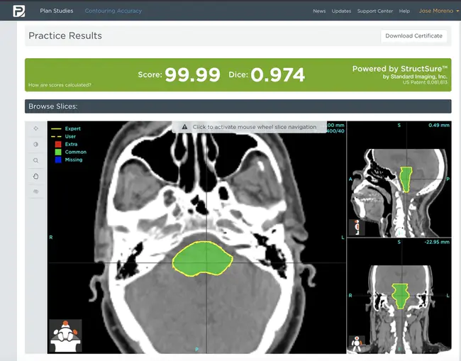 Brainstem Audio Evoked Response : 脑干音频诱发反应