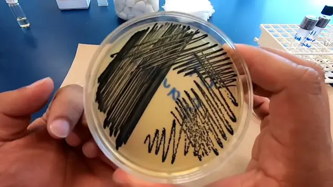 Staphylococcus Aureus Meticilino Resistente : 耐甲氧西林金黄色葡萄球菌