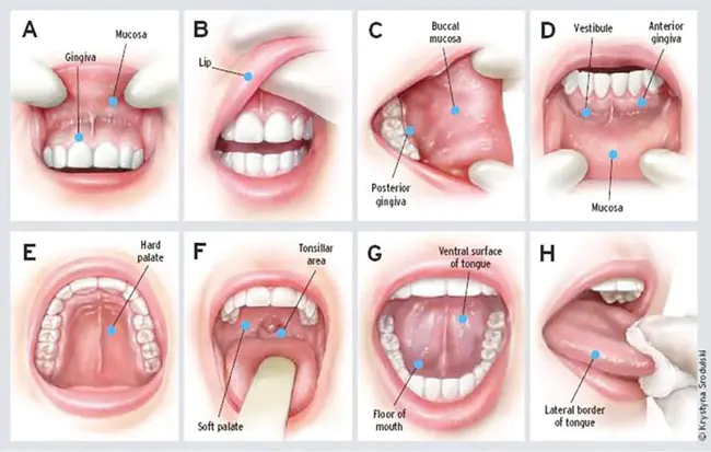 Oral Cancer Foundation : 口腔癌基金会