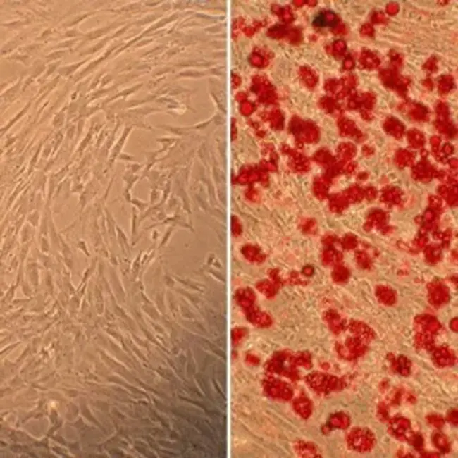 Human Marrow Stromal Cells : 人骨髓基质细胞