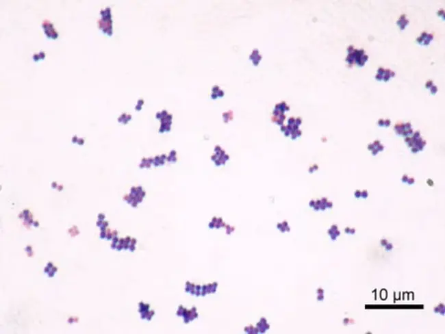 Vancomycin intermediate Staphylococcus aureus : 万古霉素中间金黄色葡萄球菌