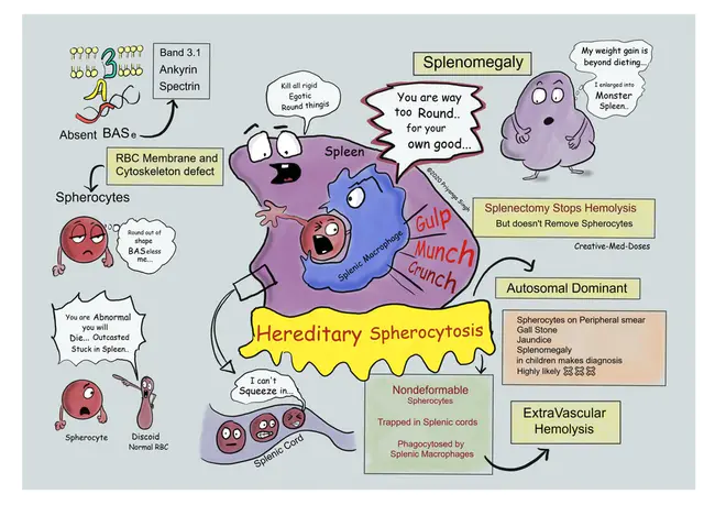 Hereditary Pancreatitis : 遗传性胰腺炎