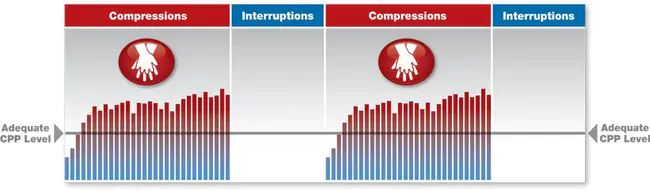 Cardio Pulmonary Resuscitation : 心肺复苏