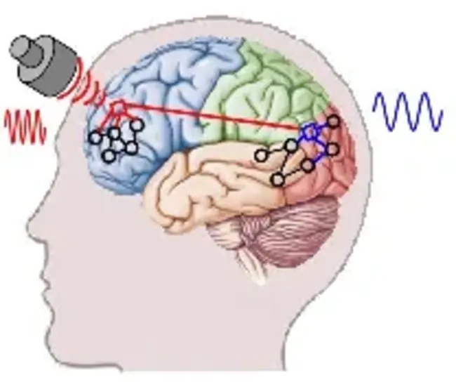 Transcranial Random Noise Stimulation : 经颅随机噪声刺激