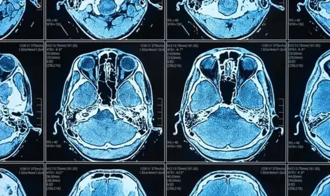 Valley Radiology Imaging : 山谷放射成像