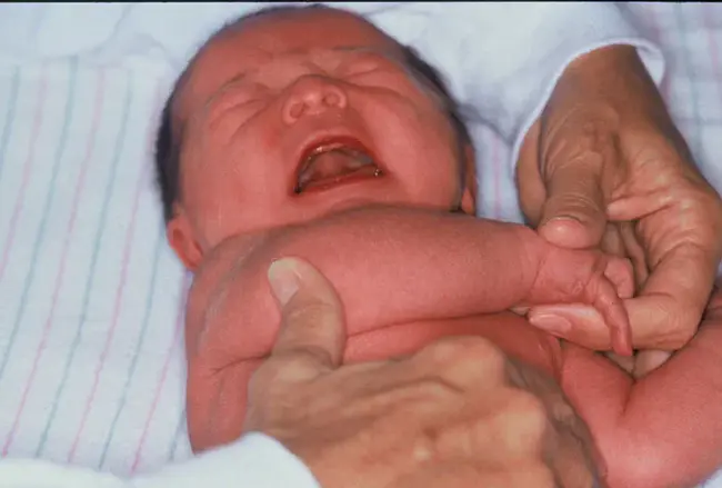 Black Infant Health : 黑人婴儿健康