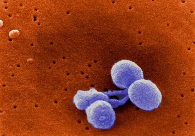 Streptococcus pneumoniae : 肺炎链球菌