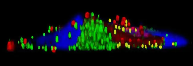 Confocal Scanning Laser Microscopy : 聚焦扫描激光显微镜