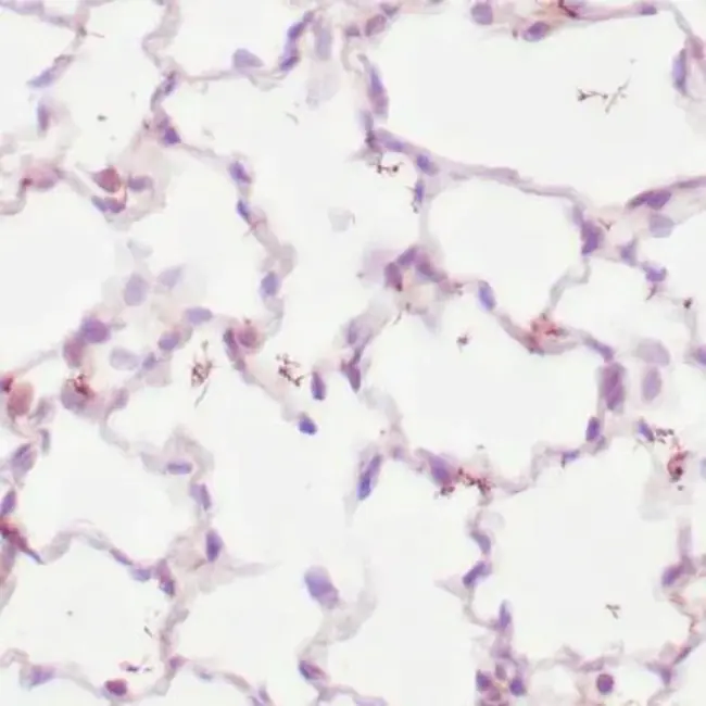 Treponema Pallidum Hämagglutinations Assay : 梅毒螺旋体溶胀试验