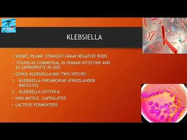 Klebs Loeffler bacillus : Klebs-Loefler芽孢杆菌
