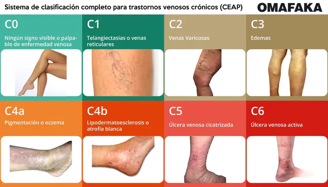 Association canadienne de physiothérapie : 加拿大物理治疗协会