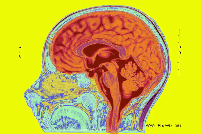 Dynamic Deconstructive Psychotherapy : 动态解构心理治疗