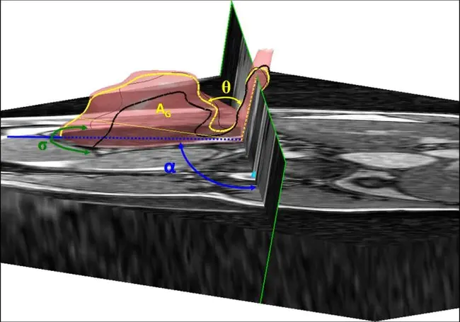 Anatomical Impairment Measurements : 解剖损伤测量