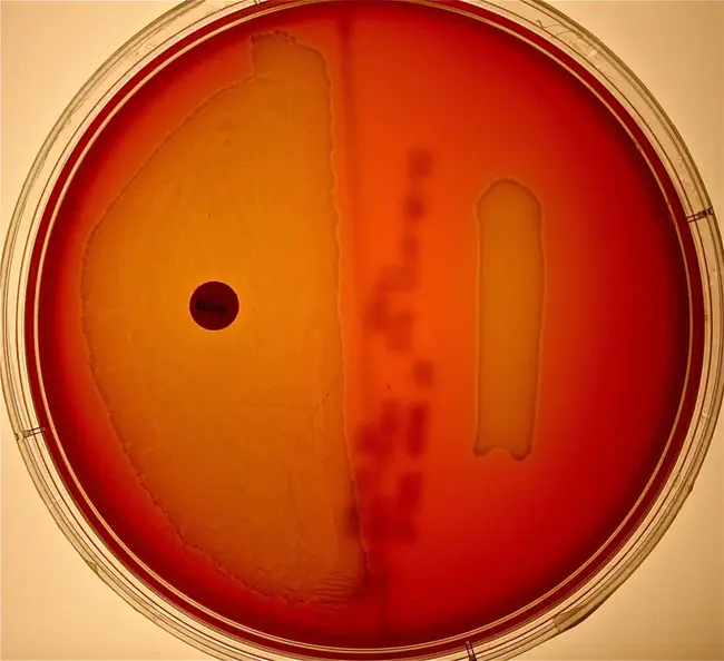 Streptomyces Actinomyces Nocardia Nocardiopsis Actinomadura : 诺卡氏链霉菌