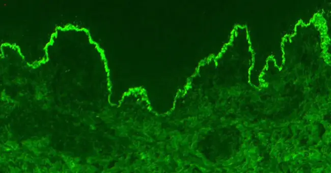 Experimental Dermato Immuno Pathology : 实验性皮肤免疫病理学