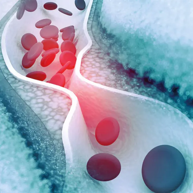 Vascular Biology and Therapeutics : 血管生物学与治疗学