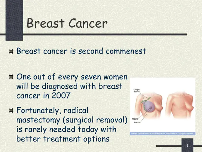 Early Breast Cancer : 早期乳腺癌