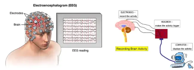 Electroencephalography and Clinical Neuroscience Society : 脑电图与临床神经科学学会