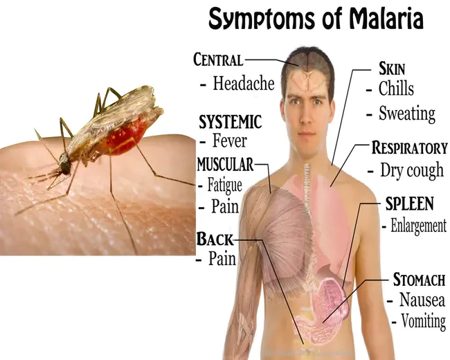 Malaria Capacity Development Consortium : 疟疾能力发展联合会