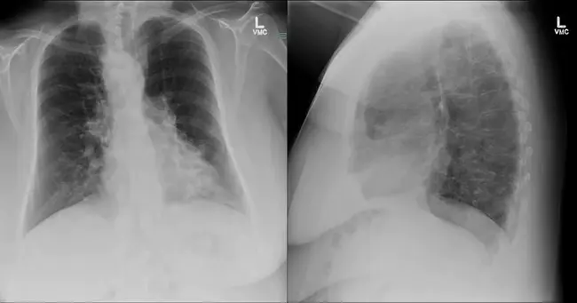 Center for Radiological Research : 放射研究中心