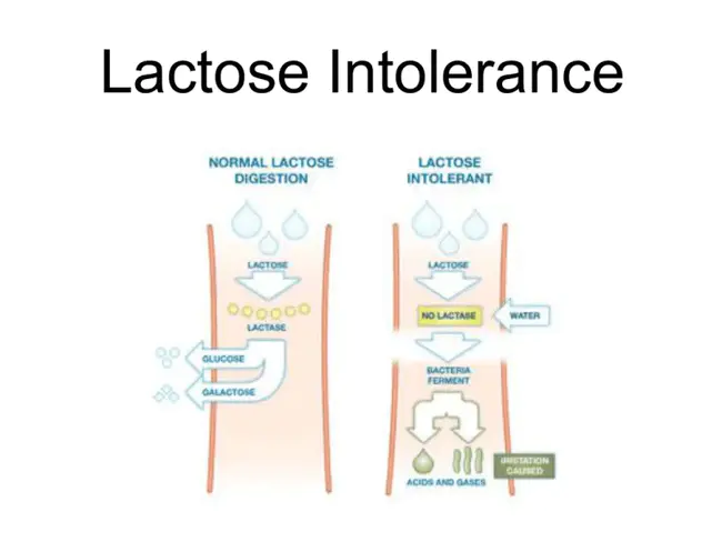 Lactose Intolerance : 乳糖不耐症