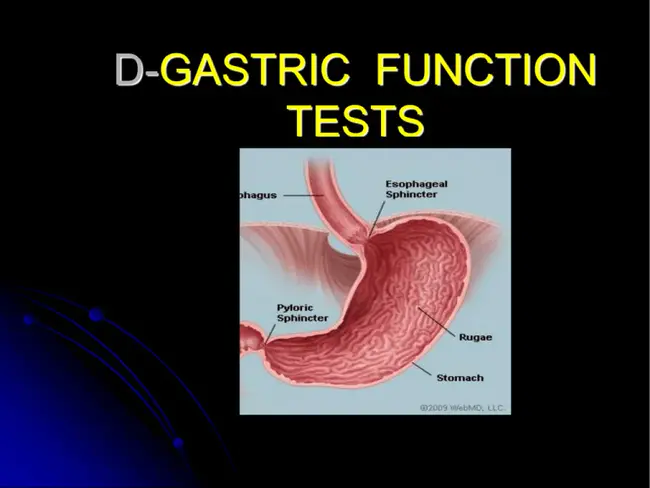 Gastric Intestinal Tract : 胃肠道