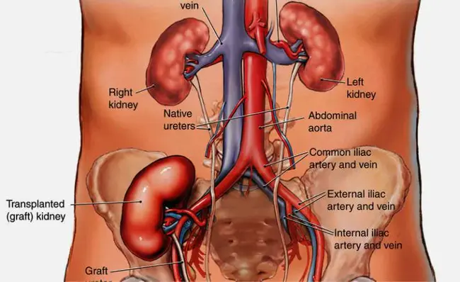 Kidney Transplantation : 肾移植