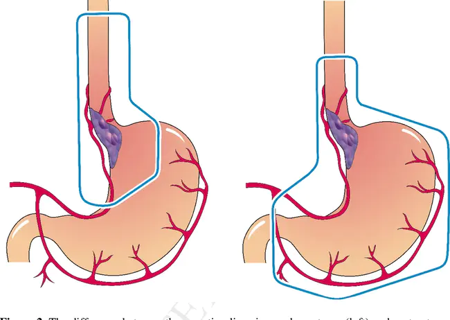 Esophago Gastro Duodenoscopy : 食管胃十二指肠镜检查