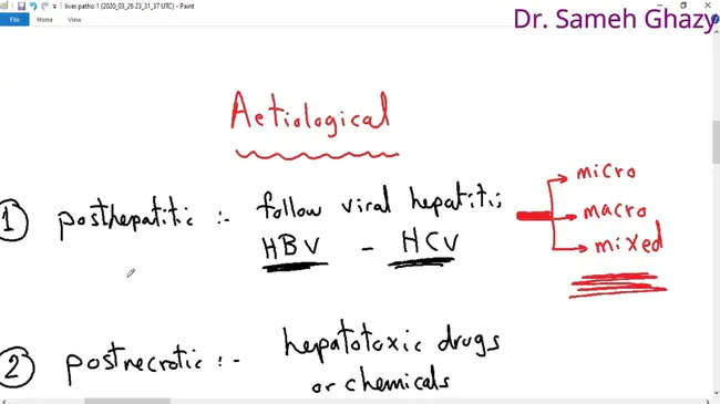 Hepato Pancreatic and Biliary : 肝胰胆管