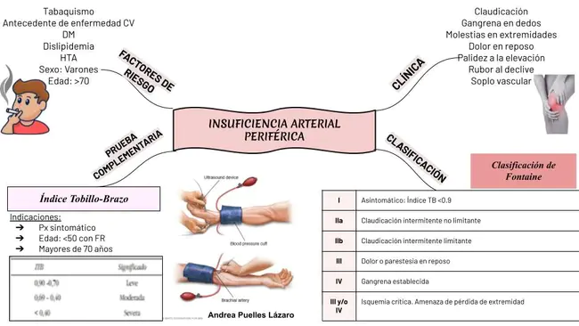 Peripheral Occlusive Vascular Disease : 周围闭塞性血管病